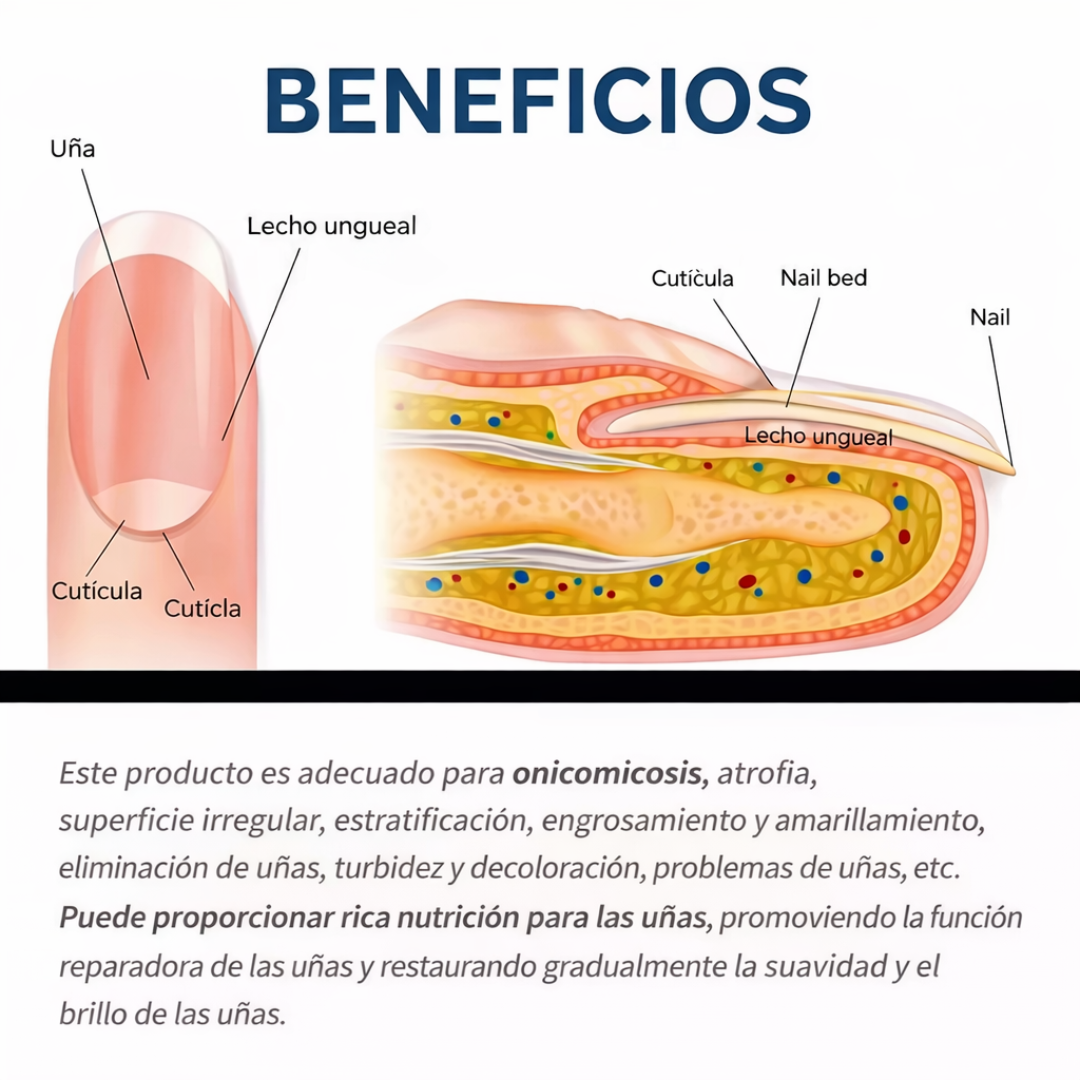 Parches Antihongos para Uñas – Reparación Intensiva y Renovación Visible