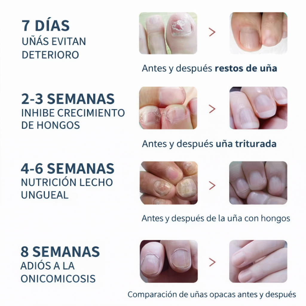 Parches Antihongos para Uñas – Reparación Intensiva y Renovación Visible