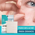 Parches para tratamiento del Acné