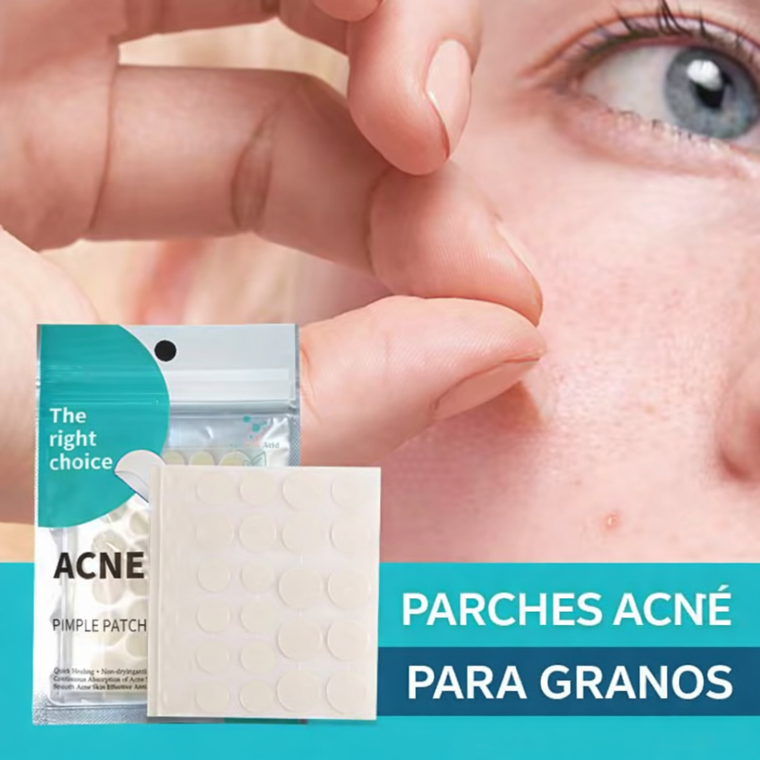 Parches para tratamiento del Acné