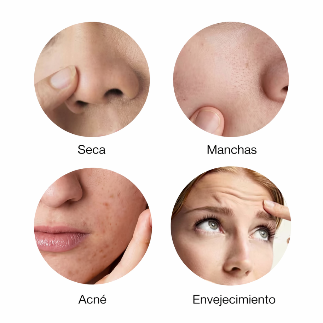 ✨ Dispositivo Facial 3 en 1 HIFU + RF + EMS